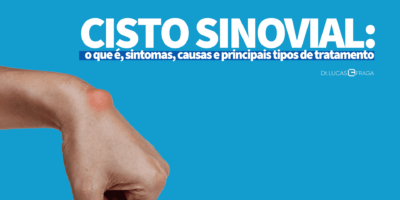 Cisto Sinovial